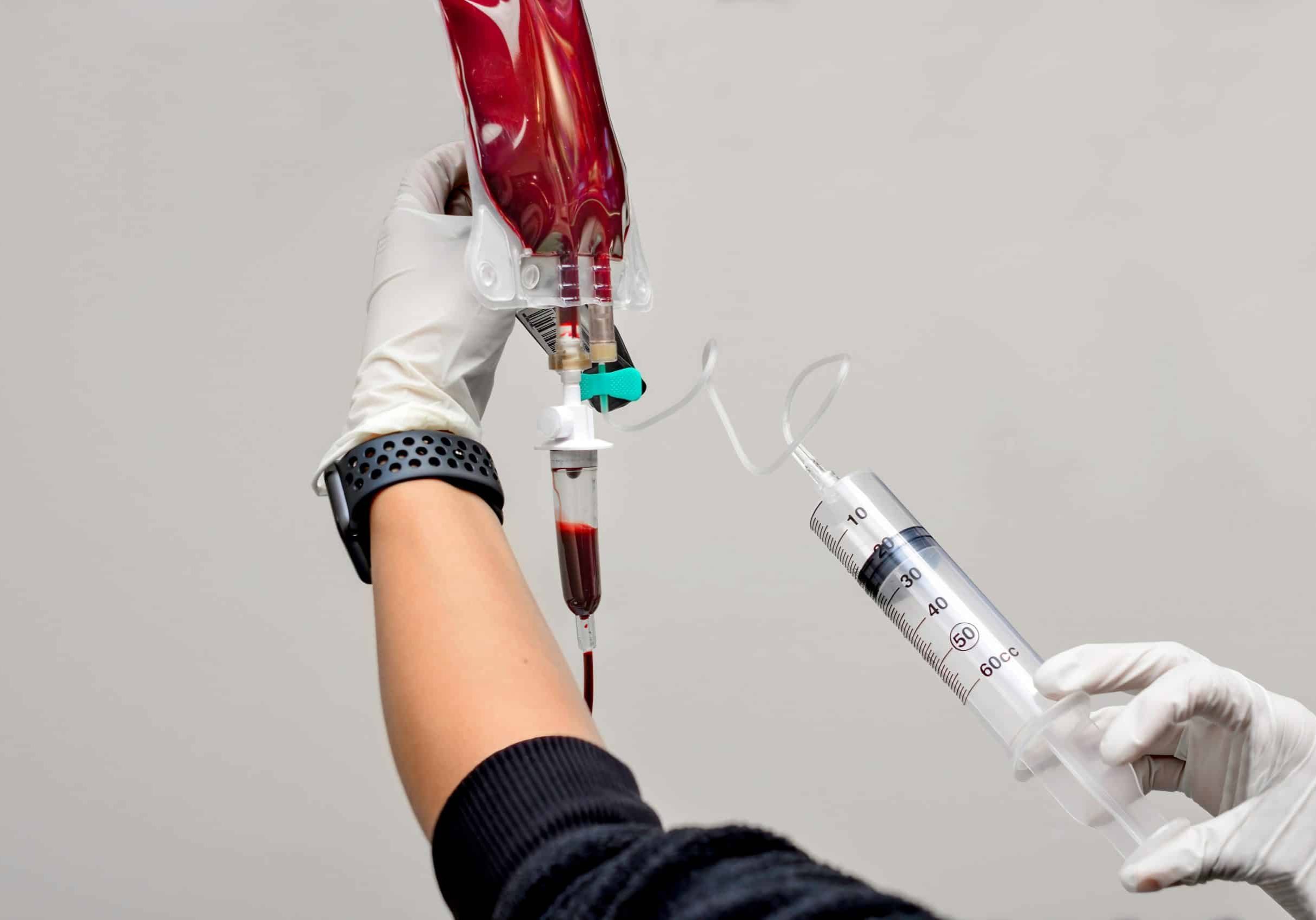 Nurse,Injecting,Ozone,Into,An,Iv,Bag,Full,Of,The